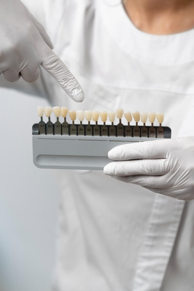 Lentes de Contato Dental Guaíba RS