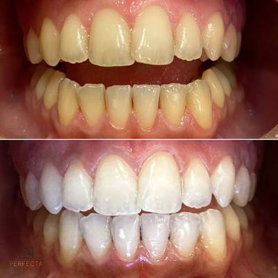 Dentista em Guaíba - RS