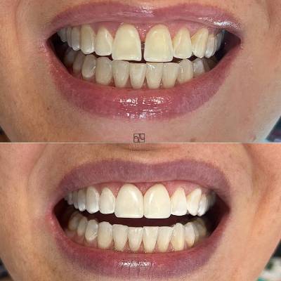 Dentista em Guaíba - RS