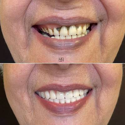 Dentista em Guaíba - RS